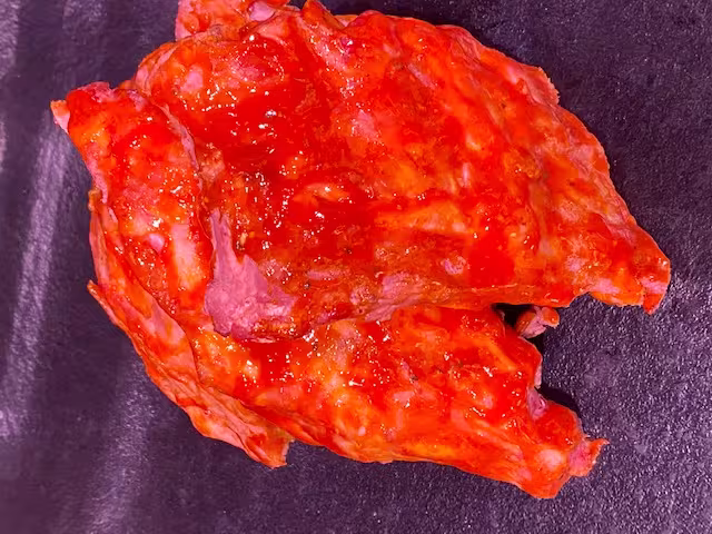 Spareribs mit Honigmarinade - Spar-ribs