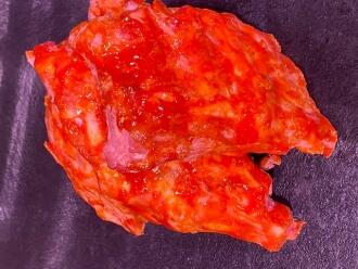 Spar-ribs